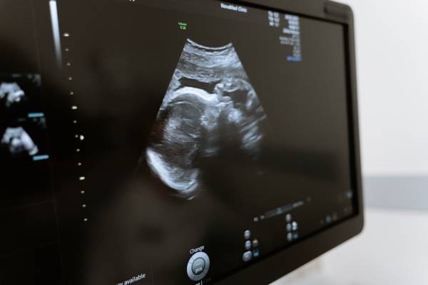 Foetal 2D Echo Test